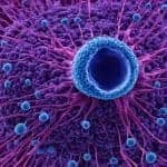 Epigenetic modulation advanced prostate cancer